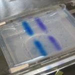 Read more about the article 10 Uses of Gel Electrophoresis
