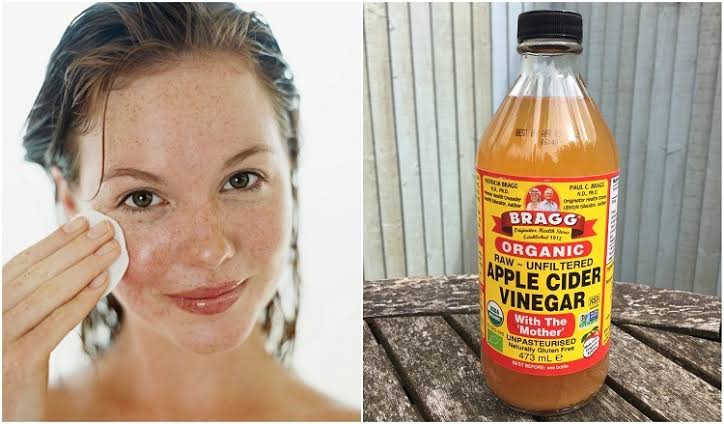You are currently viewing 100 apple cider vinegar uses for the skin